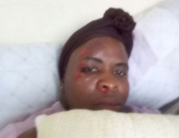 METRORAIL ACCESS CONTROLLER ASSAULTED, LEFT WITH A BROKEN ARM